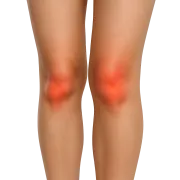 Antiinflamatorios
